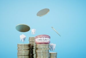 all 4 dental implants cost factors