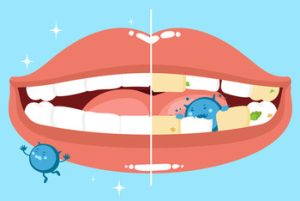 Bad Breath Causes decay