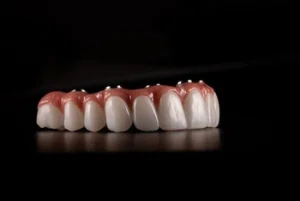 Side Effects of Ill-Fitting Dentures implant retained