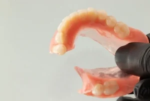 snap in dentures set